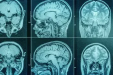 Transgender Identities and the Brain