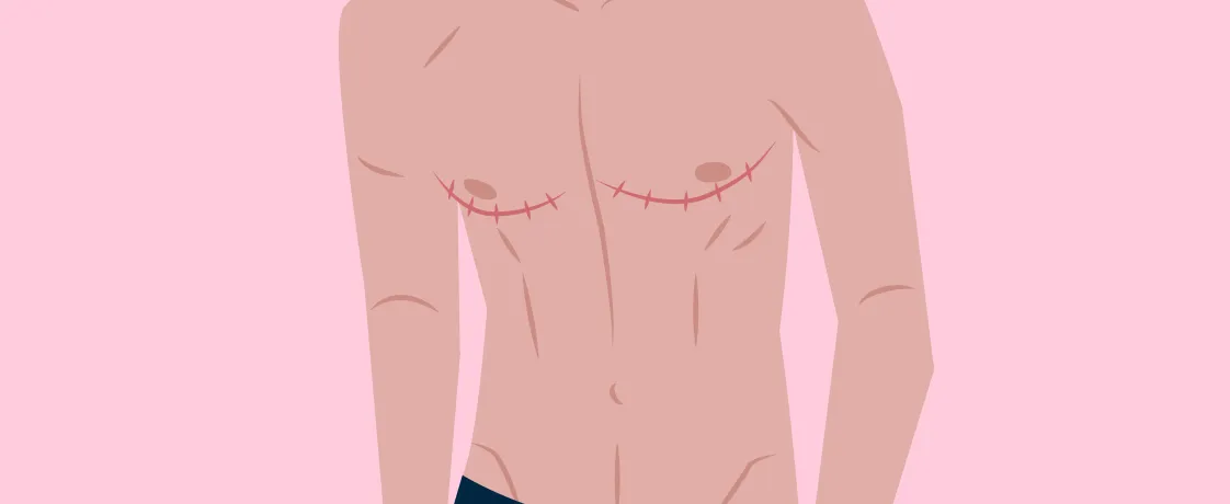 Critical Appraisal of “Long-Term Regret and Satisfaction With Decision Following Gender-Affirming Mastectomy"
