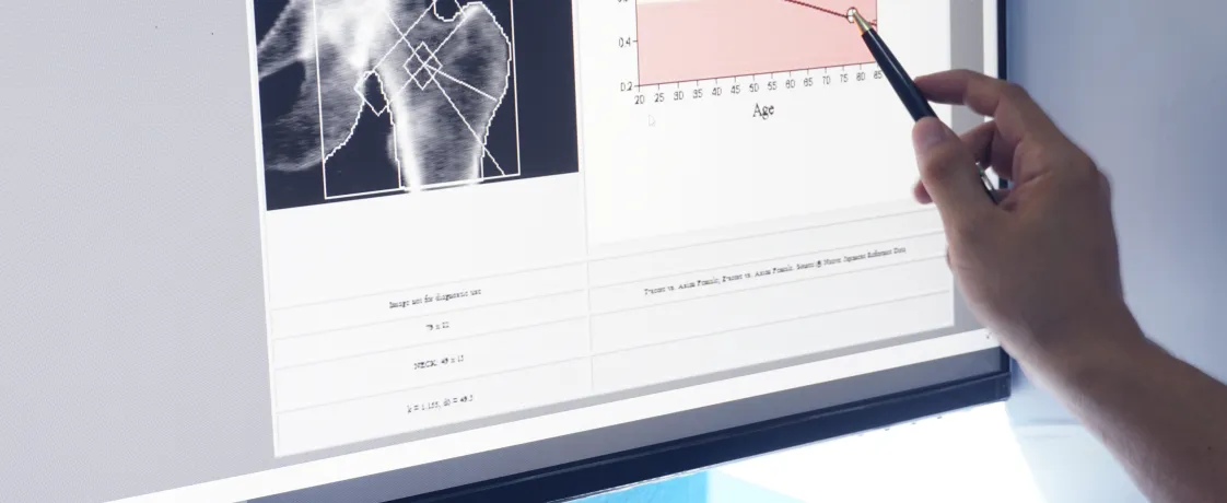 The Effect of Puberty Blockers on the Accrual of Bone Mass