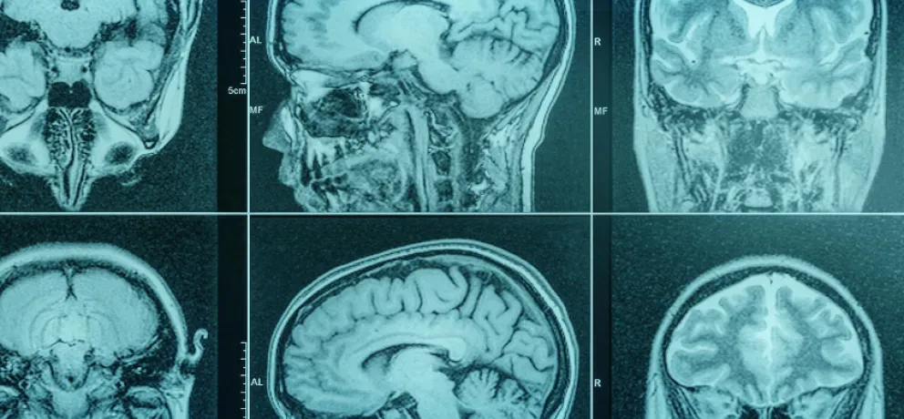 Transgender Identities and the Brain