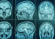 Transgender Identities and the Brain
